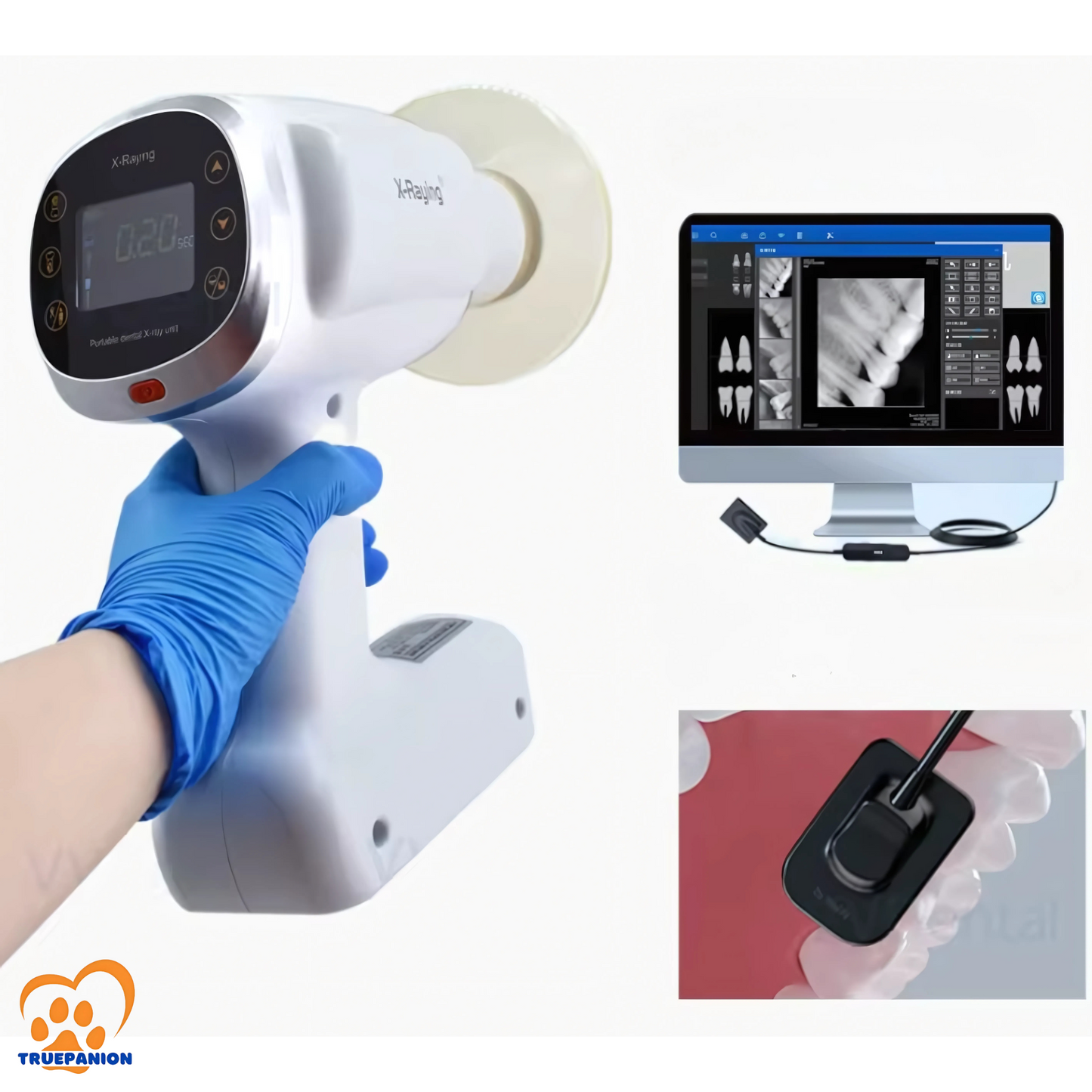 Portable Dental X-ray with Digital Intraoral Sensor